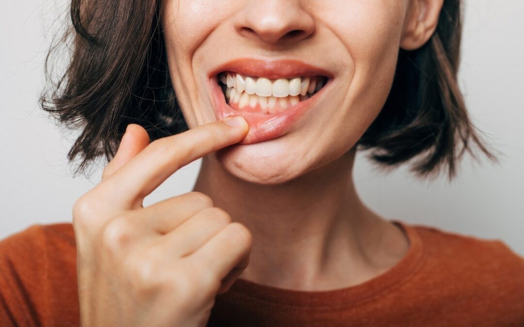 Gencives rouges, caries, haleine… avez-vous une bonne hygiène bucco-dentaire ?