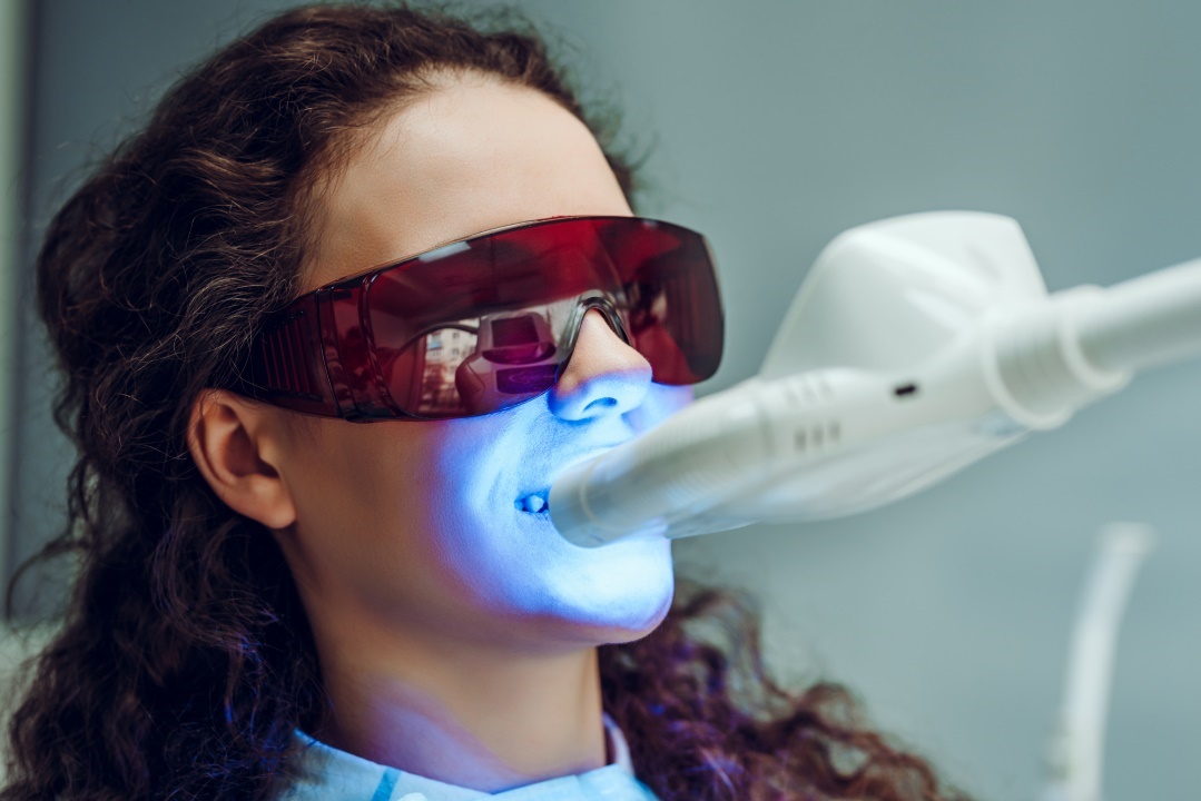 Quelle sont les techniques de blanchiment dentaire chez le dentiste lumière
